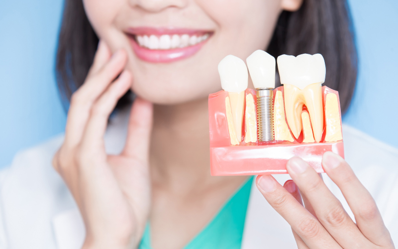 インプラントを検討されている方へ