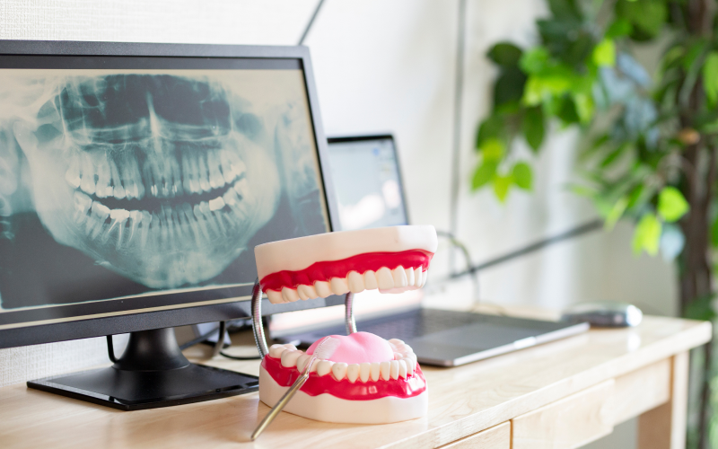 つめ物・かぶせ物をお考えの方へ